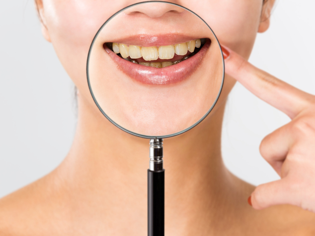 Orthodontic Braces